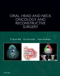 Oral, Head and Neck Oncology and Reconstructive Surgery