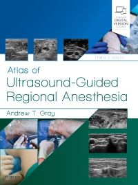 Atlas of Ultrasound-Guided Regional Anesthesia