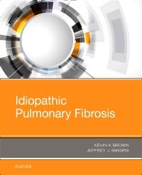 Idiopathic Pulmonary Fibrosis