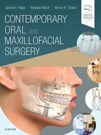 Contemporary Oral and Maxillofacial Surgery