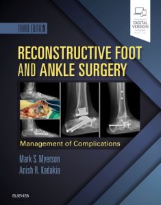 Reconstructive Foot and Ankle Surgery: Management of Complications