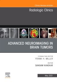 Advanced Neuroimaging in Brain Tumors, An Issue of Radiologic Clinics of North America