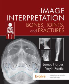 Image Interpretation: Bones, Joints, and Fractures