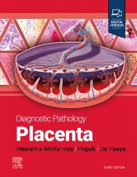 Diagnostic Pathology: Placenta