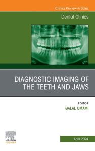 Diagnostic Imaging of the Teeth and Jaws, An Issue of Dental Clinics of North America