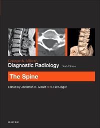 Grainger & Allison’s Diagnostic Radiology: The Spine