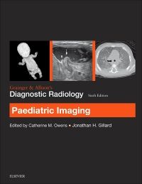 Grainger & Allison’s Diagnostic Radiology: Paediatric Imaging