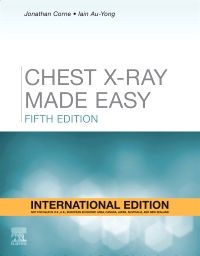 Chest X-Ray Made Easy, International Edition