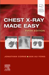 Chest X-Ray Made Easy