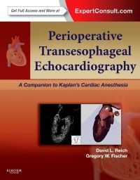 Perioperative Transesophageal Echocardiography